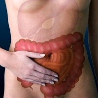Doença de Crohn